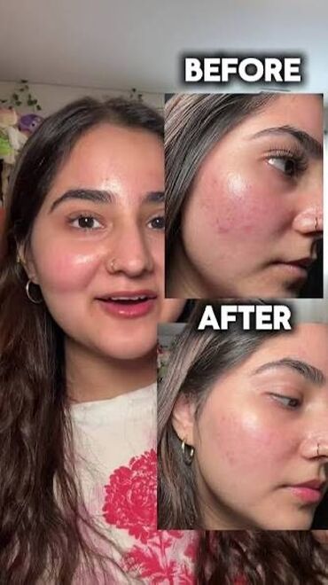 Косметика: 🔥 НАБОР (2шт сыворотки и увлажняющий крем)Reedle Shot Duo Set — — 7