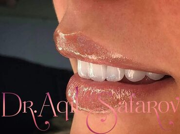 Stomatologiya: 💫Ramazan ayı ilə əlaqədar Kampaniya✨🌟⭐💫 🌊🔥Diş Həkimi 🔥🌊 Qiymətləri — 2