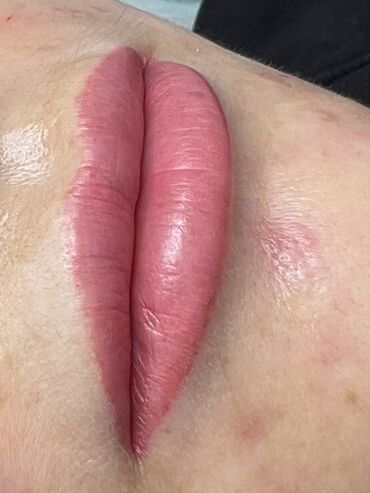 Косметология: Косметология, Ботокс, Биоревитализация, Ботулинотерапия, Консультация, Гипоаллергенные материалы, Сертифицированный косметолог — 40