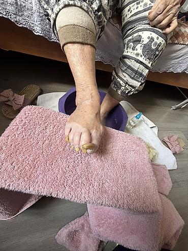 опиль: Коррекция вросших ногтей, Педикюр, С выездом на дом — 1