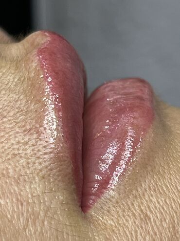 Косметология: Косметология, Маски, Мезотерапия, Удаление носогубных складок, Гипоаллергенные материалы, Консультация, Сертифицированный косметолог — 62