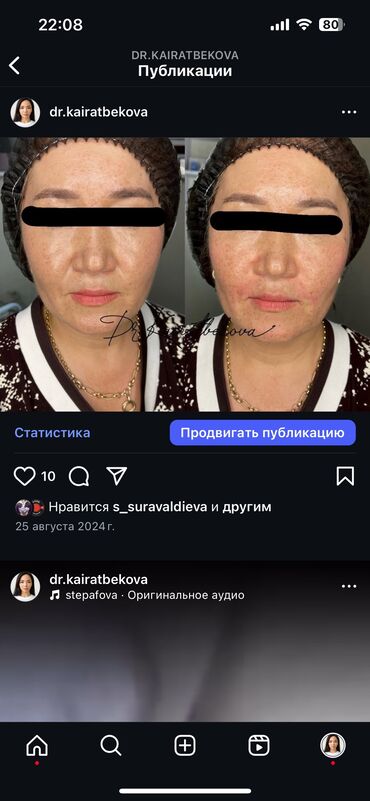 Косметология: Косметология, Биоревитализация, Ботокс, Ботулинотерапия, Требуются модели, Гипоаллергенные материалы, Консультация — 11