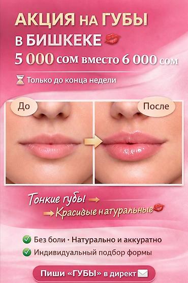 смас лифтинг: Увеличение и коррекция губ в Бишкеке - Акция: 5 000 сом вместо 6 000 — 2