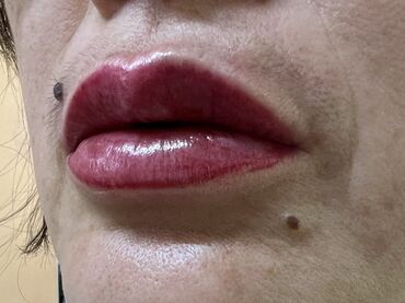 Косметология: Косметология, Маски, Мезотерапия, Удаление носогубных складок, Гипоаллергенные материалы, Консультация, Сертифицированный косметолог — 85