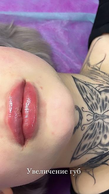 Косметология: Косметология, Ботокс, Биоревитализация, Ботулинотерапия, Консультация, Гипоаллергенные материалы, Сертифицированный косметолог at lalafo.kg — 12 Косметология: Косметология, Ботокс, Биоревитализация, Ботулинотерапия, Консультация, Гипоаллергенные материалы, Сертифицированный косметолог — 12