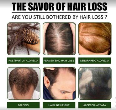 Уход за телом: США Спрей для роста волос Против выпадения волос и стимулирующий — 6