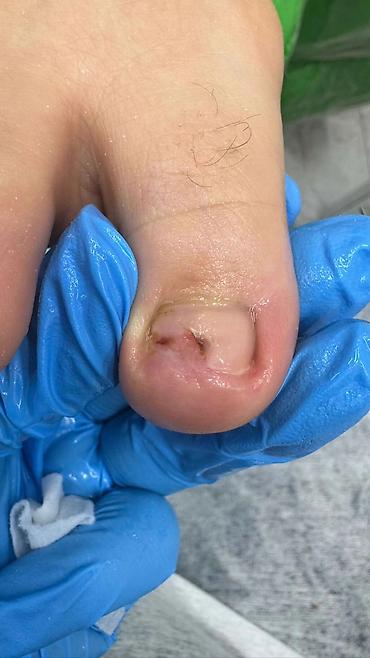 Маникюр: Коррекция вросших ногтей, Маникюр, Педикюр, Услуги подолога, С выездом на дом, Консультация, Одноразовые расходные материалы — 14