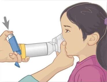 Ингаляторы, небулайзеры: Спейсеры Rabir Chamber все размеры M L S И 3 в 1 предназначен для at lalafo.kg — 4 Ингаляторы, небулайзеры: Спейсеры Rabir Chamber все размеры M L S И 3 в 1 предназначен для — 4