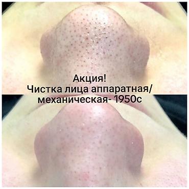 очистка мор: Косметология, Пилинг, Разглаживание и коррекция морщин, Чистка кожи, Консультация, Сертифицированный косметолог, Гипоаллергенные материалы — 1