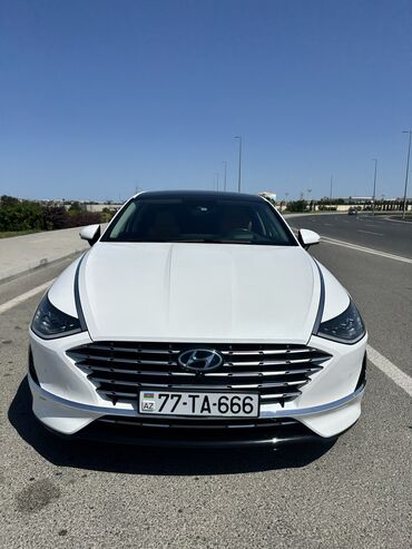 start stop qurasdirilmasi qiymeti: Aylıq, Hyundai, Depozitlə, Qalmamaq şərti ilə