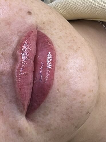 Косметология: Косметология, Маски, Мезотерапия, Удаление носогубных складок, Гипоаллергенные материалы, Консультация, Сертифицированный косметолог — 24