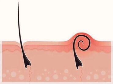 гель для бритья: Шугаринг всех зон мужской - женский