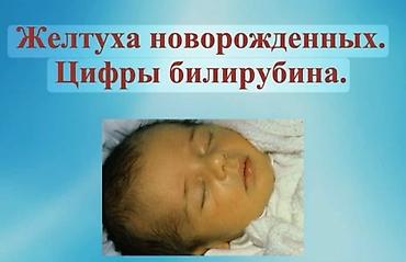 дордой одежды: Фотолампа наристелердин желтухасын үй шартында эффективдүү кетирүүчү — 6