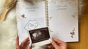 Uşaqlar üçün digər mallar: Hamiləlik Günlüyü ( Azərbaycan dilində ) Azərbaycan dilində olan — 2