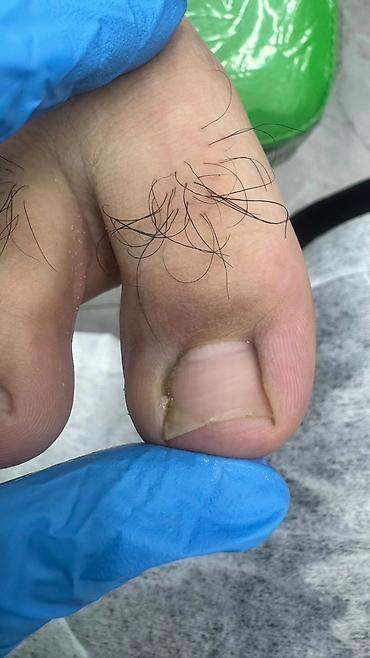 Маникюр: Коррекция вросших ногтей, Маникюр, Педикюр, Услуги подолога, С выездом на дом, Консультация, Одноразовые расходные материалы — 16