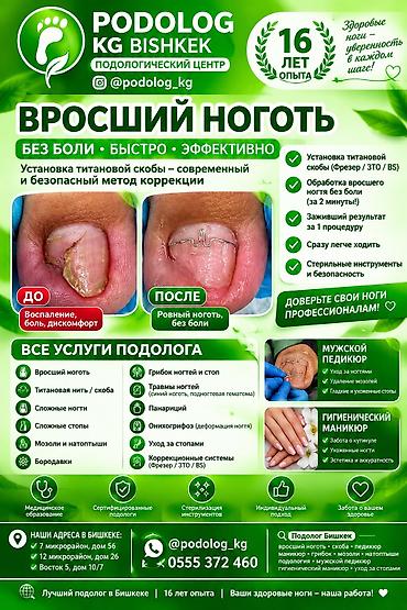 Коррекция вросших ногтей, Услуги подолога, Одноразовые расходные материалы