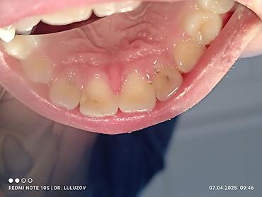 Медицинские услуги: Клиника | Стоматолог | Протезирование — 21