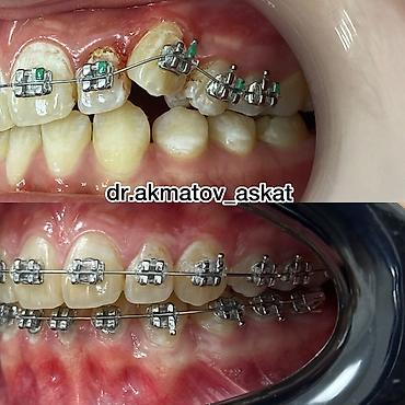 Медицинские услуги: Врачи | Стоматолог | Консультация — 5