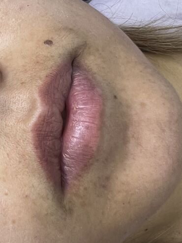 Косметология: Косметология, Ботокс, Биоревитализация, Ботулинотерапия, Консультация, Гипоаллергенные материалы, Сертифицированный косметолог — 18