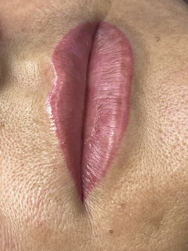 Косметология: Косметология, Маски, Мезотерапия, Удаление носогубных складок, Гипоаллергенные материалы, Консультация, Сертифицированный косметолог — 61