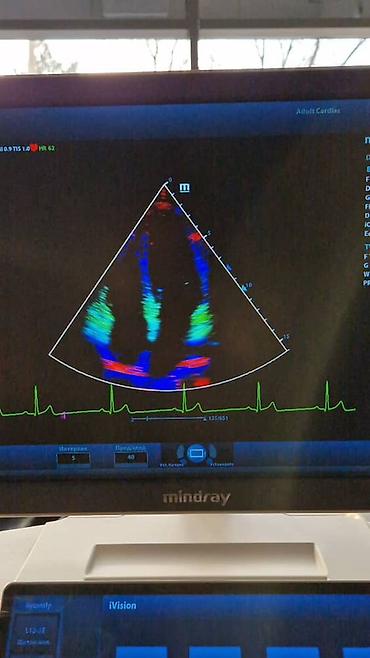 Медицинское оборудование: Продаётся УЗИ аппарат экспертного класса Mindray DC-80 X-INSIGHT — 6