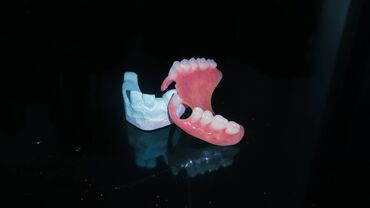 keramika diş qiymetleri 2024: 🦷 Diş Texnikliyi üzrə öyrənmək istəyən tələbə axtarılır. Sən də bu