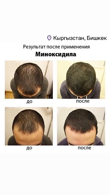 етор: Сыворотка для роста волос и бороды REAXIDIL 10% Minoxidil, 50 мл - — 9