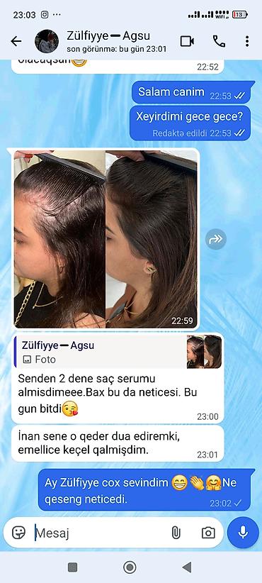 minoksidil 5 faiz: Saç Serumu – tökülmə və qırılmaya qarşı intensiv qulluq Məhsulun — 4