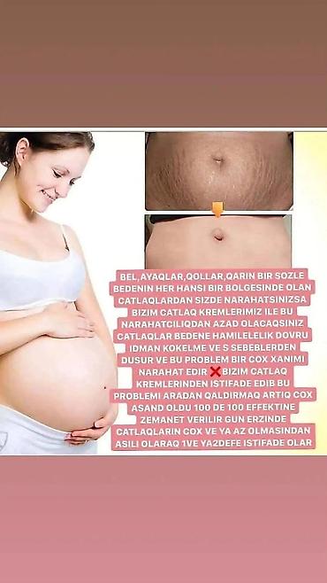 Gözəllik və sağlamlıq: Ətraflı yan şəkillərdə metrolara çatdırılma var rayona poçtla — 2