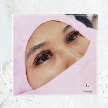 Косметология: Косметология, Ботокс, Биоревитализация, Ботулинотерапия, Консультация, Гипоаллергенные материалы, Сертифицированный косметолог — 2