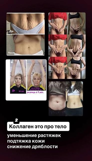 Мед. товарлар: Коллаген, Чачтын өсүшү үчүн, Универсалдуу, Желе, Жаңы — 2