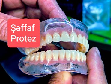 Başqa xidmətlər: Şəffaf protez müasir endirimlə