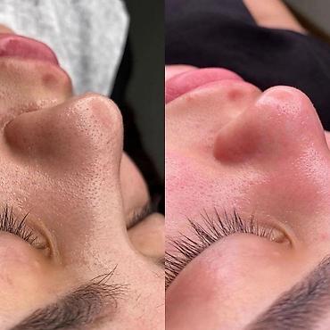 Косметология: Косметология, Чистка кожи, Массаж лица, Лечение угревой болезни, С выездом на дом, Сертифицированный косметолог, Консультация — 3