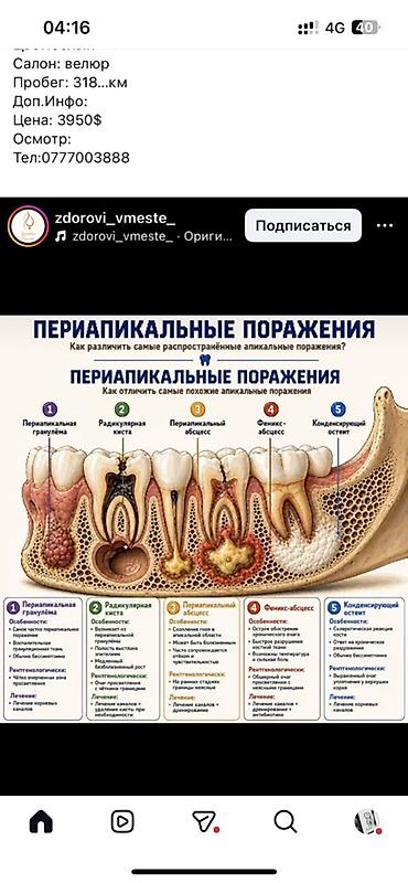 klinika satilir: Клиника | Стоматолог | Протезирование — 4