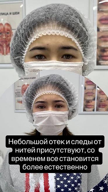 Брови: Нитевая блефаропластика «Сингапури» без операции ✨ Процедура — 4