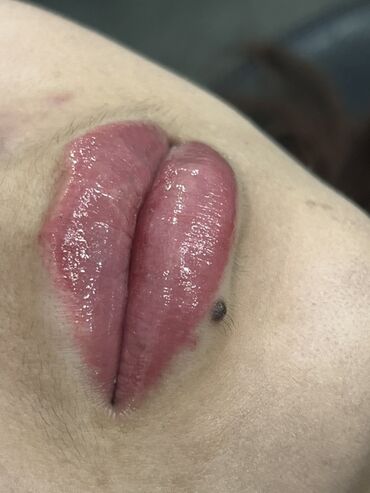 Косметология: Косметология, Маски, Мезотерапия, Удаление носогубных складок, Гипоаллергенные материалы, Консультация, Сертифицированный косметолог — 72