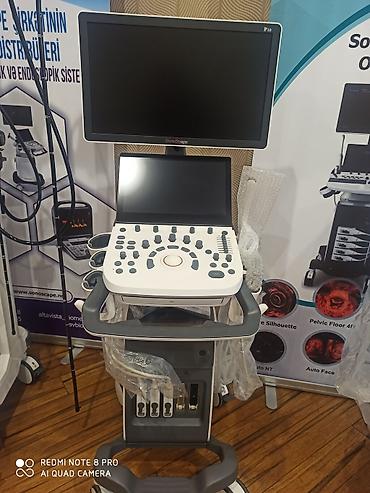 Tibbi avadanlıq: USM ( Uzi) cihazlarin 30% ilkin idenisle bütün nov USM ( Uzi) — 6