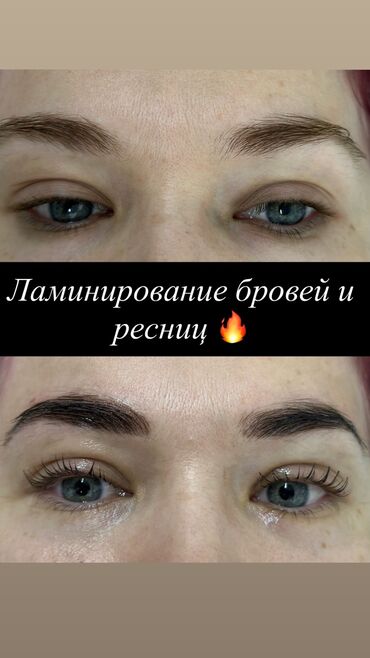 лазерная эпиляция цены: Брови, Коррекция, Ламинирование, Мусульманская коррекция, С выездом на дом, Гипоаллергенные материалы