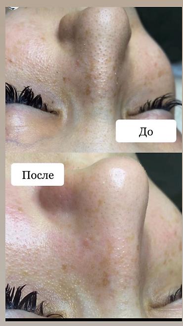 Сулуулук жана ден-соолук: ✨ Косметолог из Москвы теперь в Бишкеке! ✨ Опыт работы 5 лет — 7