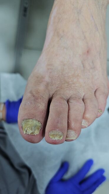 Маникюр, педикюр: Наращивание ногтей, Гель лак, шеллак, Укрепление ногтей, Услуги подолога, Маникюр, Педикюр, Консультация, Одноразовые расходные материалы — 3