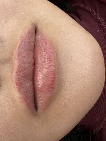 Косметология: Косметология, Ботокс, Биоревитализация, Ботулинотерапия, Консультация, Гипоаллергенные материалы, Сертифицированный косметолог — 14