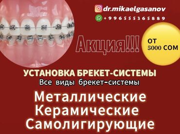 Другое: Установка брекет-систем Акция: от 5000 СОМ Доступны все виды