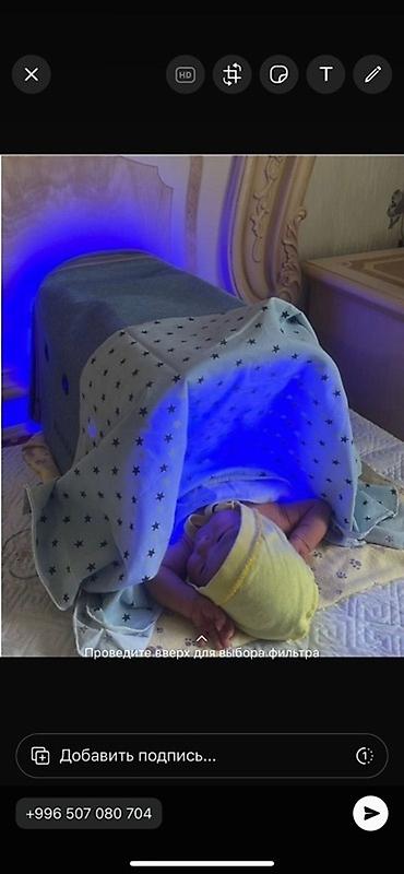 Медицинские лампы: Лампа для фототерапии новорожденных для лечения желтухи. Кювез Удобное — 3