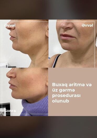 Avadanlığın icarəsi: Tecili!!! SATILIR VE YA ARENDAYA VERİLİR (AYLIQI 350 AZN)endirim — 8