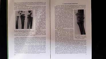 Другие книги и журналы: Рейнберг С.А. Рентгенодиагностика заболеваний костей и суставов. В — 7