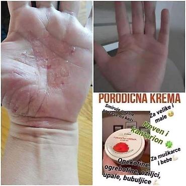 Породична КРЕМА НА биљној бази! ☝️🌿☘️☘️🌿💪 * Против опекотина; 👌/ 🔥 *