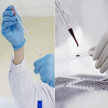 Qab-qacaq və mətbəx ləvazimatları: ﻿Şüşə pipet (pipetka) Laboratoriya üçün maye damcılayıcı. Şkalalı — 4