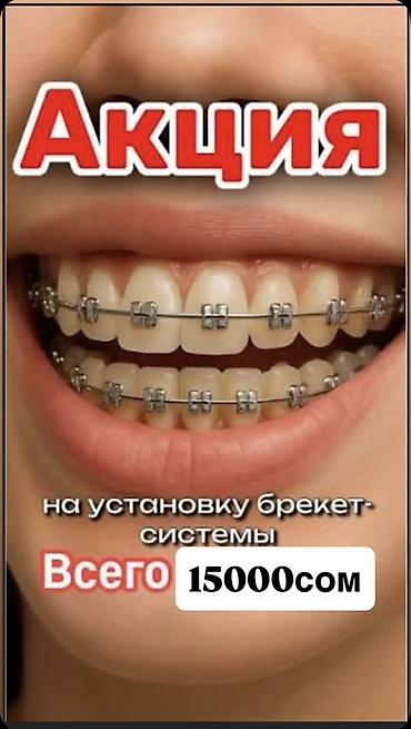 установка брекет: Услуга: установка брекет‑системы на обе челюсти. - Акция: стоимость — 1
