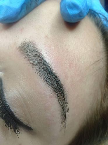 Косметология: Косметология, Ботокс, Биоревитализация, Ботулинотерапия, С выездом на дом, Консультация, Гипоаллергенные материалы — 21