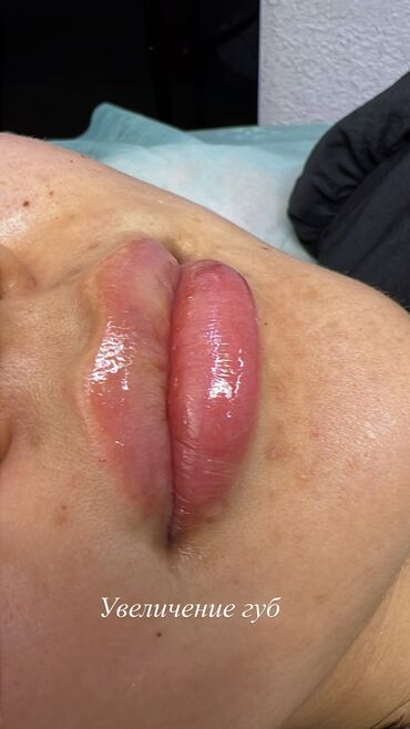 Косметология: Косметология, Биоревитализация, Ботокс, Демодекоз, Гипоаллергенные материалы, Консультация, Сертифицированный косметолог — 24